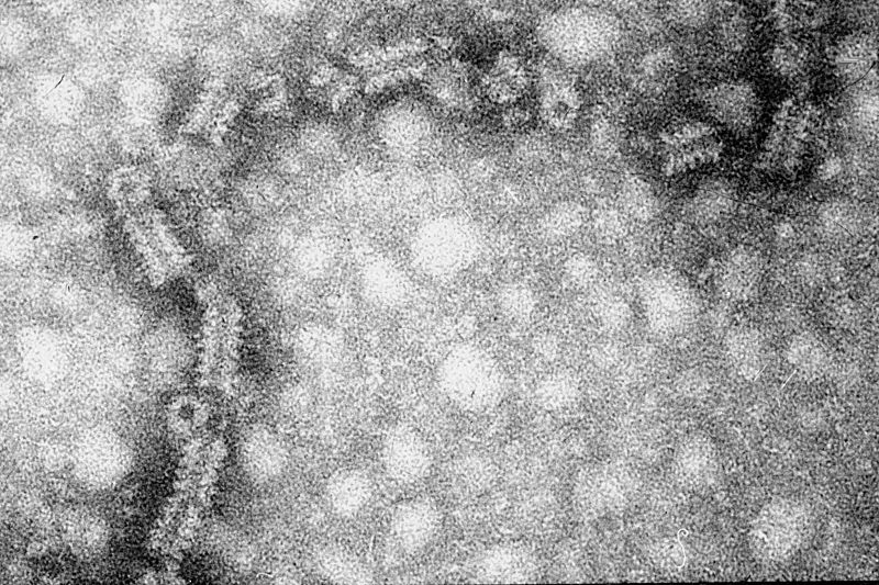 Several mumps diagnoses prompt Brussels university to issue warning
