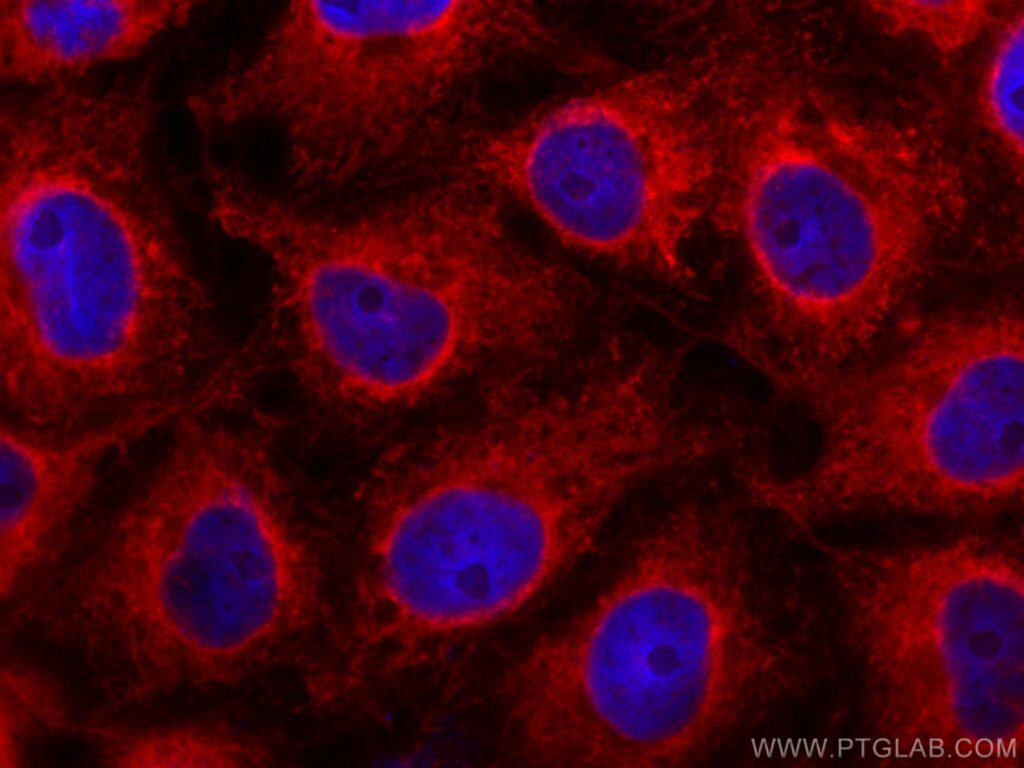 Belgian study finds specific gene mutation responsible for Dementia and Sclerosis